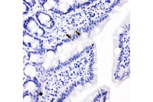 IHC testing of FFPE rat intestine with PYY antibody.