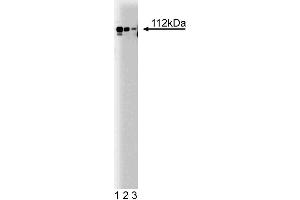 Western blot analysis of Adaptin alpha on a rat cerebrum lysate.