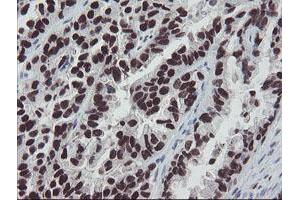 Image no. 2 for anti-Meis Homeobox 3 (MEIS3) (AA 1-261) antibody (ABIN1490670)