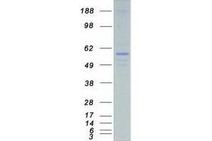 Validation with Western Blot