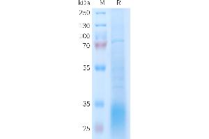 Human R Protein, His Tag on SDS-PAGE under reducing condition.