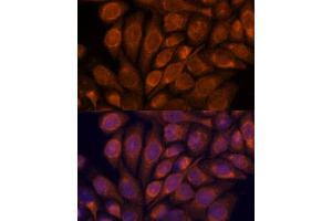 Immunofluorescence analysis of HeLa cells using IPO4 antibody  at dilution of 1:100.