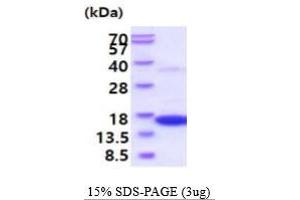 SDS-PAGE (SDS) image for Interferon gamma (IFNG) (AA 23-155) protein (His tag) (ABIN5854798)