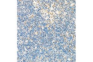 Immunohistochemistry of paraffin embedded rat thymus using Skar (ABIN7074970) at dilution of 1:1800 (400x lens) (p46 anticorps)