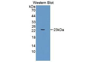 Western blot analysis of the recombinant protein. (UACA anticorps  (AA 29-209))
