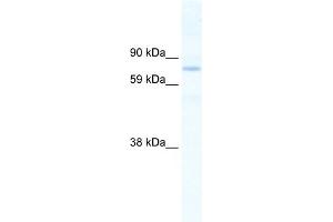 WB Suggested Anti-SIN3B Antibody Titration:  2. (SIN3B anticorps  (N-Term))