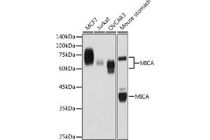 Western blot analysis of extracts of various cell lines, using MICA antibody (ABIN7268508) at 1:1000 dilution. (MICA anticorps)