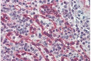 Human Spleen: Formalin-Fixed, Paraffin-Embedded (FFPE) (IRAK2 anticorps  (AA 111-210))