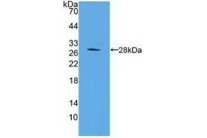 Detection of Recombinant PSMD10, Human using Polyclonal Antibody to Proteasome 26S Subunit, Non ATPase 10 (PSMD10) (PSMD10 anticorps  (AA 1-226))