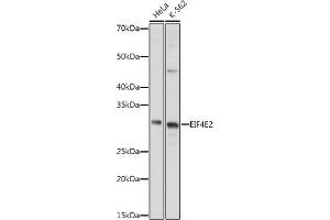 Western blot analysis of extracts of various cell lines, using EIF4E2 antibody (ABIN6130366, ABIN6140086, ABIN6140087 and ABIN6220578) at 1:1000 dilution. (EIF4E2 anticorps  (AA 1-240))