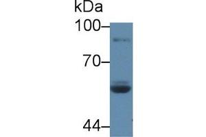 Detection of LPO in Human Saliva using Polyclonal Antibody to Lactoperoxidase (LPO) (LPO anticorps  (AA 351-589))