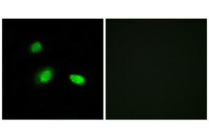 Immunofluorescence analysis of A549 cells, using HSPB2 antibody. (HSPB2 anticorps  (C-Term))