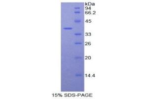 SDS-PAGE (SDS) image for Fibulin 4 (FBLN4) (AA 278-366) protein (His tag,GST tag) (ABIN1878383)