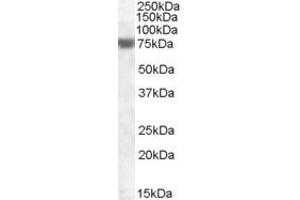 Western Blotting (WB) image for anti-Fem-1 Homolog A (FEM1A) (AA 656-669) antibody (ABIN490527) (FEM1A anticorps  (AA 656-669))