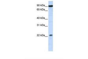 Image no. 1 for anti-Transmembrane and Tetratricopeptide Repeat Containing 4 (TMTC4) (AA 650-699) antibody (ABIN6738139) (TMTC4 anticorps  (AA 650-699))