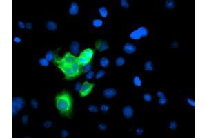 Image no. 4 for anti-Cytochrome P450, Family 2, Subfamily A, Polypeptide 6 (CYP2A6) antibody (ABIN1497723)