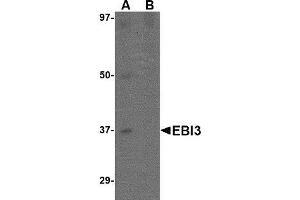 Western blot analysis of EBI3 in K562 lysate with AP30306PU-N EBI3 antibody at 1 μg/ml in (A) the absence and (B) the presence of blocking peptide. (EBI3 anticorps  (C-Term))