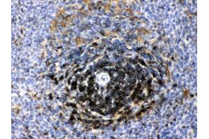 LDHB was detected in paraffin-embedded sections of rat spleen tissues using rabbit anti- LDHB Antigen Affinity purified polyclonal antibody (Catalog # ) at 1 ?