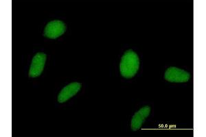Immunofluorescence of purified MaxPab antibody to SPOP on HeLa cell. (SPOP-B anticorps  (AA 1-374))