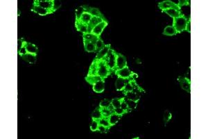 Figure:FITC staining on IHC-P Simple: Mcf7 cells (Hexokinase 2 anticorps  (AA 619-917))