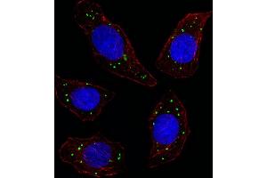 Fluorescent image of U251 cell stained with MERTK Antibody. (MERTK anticorps)