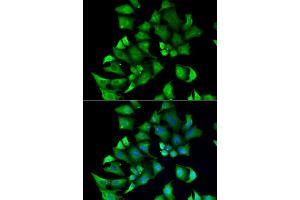 Immunofluorescence analysis of A549 cells using ENTPD2 antibody. (ENTPD2 anticorps)