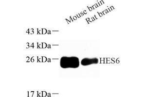 Western blot analysis of HES6 (ABIN7074161) at dilution of 1: 500 (HES6 anticorps)