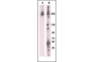Western blot analysis of RK8 (LRRK2) (arrow) using rabbit polyclonal RK8 (LRRK2)Antibody  g. (LRRK2 anticorps  (AA 931-962))