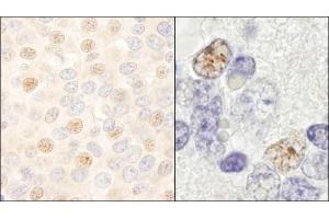 anti-DEAD (Asp-Glu-Ala-Asp) Box Polypeptide 46 (DDX46) (C-Term) antibody