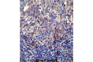 Immunohistochemistry (IHC) image for anti-B-Cell CLL/lymphoma 10 (BCL10) antibody (ABIN2995789)