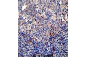 Immunohistochemistry (IHC) image for anti-B-Cell CLL/lymphoma 10 (BCL10) antibody (ABIN2995789) (BCL10 anticorps)