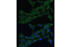 Immunofluorescence analysis of C6 cells using ETFB Polyclonal Antibody (ABIN7266916) at dilution of 1:100 (40x lens). (ETFB anticorps  (AA 80-230))