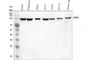 Western blot analysis of MSH2 using anti-MSH2 antibody (ABIN3043885). (MSH2 anticorps  (AA 337-583))