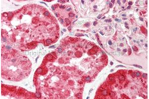 Rabbit Anti-CES2 antibody  Formalin Fixed Paraffin Embedded Tissue: Human Adult Kidney  Observed Staining: Cytoplasm in hepatocytes Primary Antibody Concentration: 1:600 Secondary Antibody: Donkey anti-Rabbit-Cy3 Secondary Antibody Concentration: 1:200 Magnification: 20X Exposure Time: 0. (CES2 anticorps  (C-Term))
