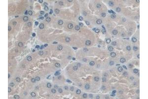 DAB staining on IHC-P; Samples: Mouse Kidney Tissue (PICK1 anticorps  (AA 24-229))