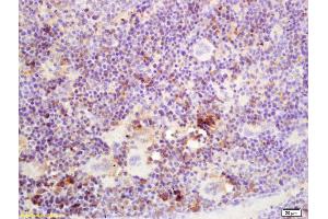Formalin-fixed and paraffin embedded mouse spleen labeled with Rabbit Anti SSA/52KDa Ro3 Polyclonal Antibody, Unconjugated (ABIN671196) at 1:200 followed by conjugation to the secondary antibody and DAB staining (TRIM21 anticorps  (AA 301-400))