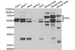 Western blot analysis of extracts of various cell lines, using CD36 antibody. (CD36 anticorps)