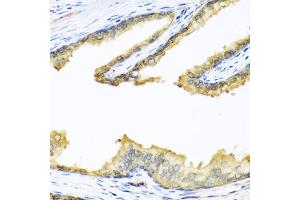 Immunohistochemistry of paraffin-embedded human prostate using PENK antibody (ABIN6133151, ABIN6145444, ABIN6145445 and ABIN6221906) at dilution of 1:100 (40x lens).