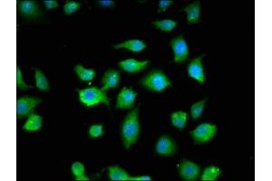 Immunofluorescence staining of A549 cells with ABIN7160609 at 1:200, counter-stained with DAPI. (MYBPC1 anticorps  (AA 618-779))