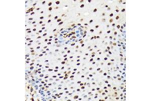 Immunohistochemistry of paraffin-embedded human esophageal using PRP19 Rabbit mAb (ABIN7269505) at dilution of 1:100 (40x lens). (PRP19 anticorps)