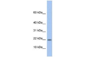 WB Suggested Anti-NDP Antibody Titration: 0. (Norrie Disease (Pseudoglioma) anticorps  (Middle Region))
