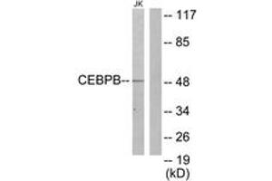 Western blot analysis of extracts from Jurkat cells, using CEBPB Antibody. (CEBPB anticorps  (AA 231-280))