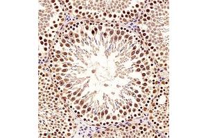 Immunohistochemistry of paraffin embedded rat testis using TBCldl (ABIN7075843) at dilution of 1:2000 (250x lens)