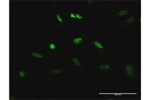 Immunofluorescence of purified MaxPab antibody to TCEB3 on HeLa cell.