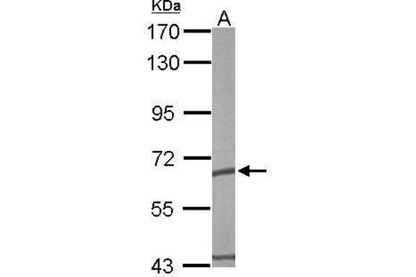 CCT5 antibody