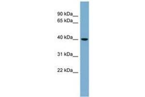 VPS37C anticorps  (AA 35-84)