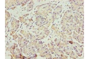 Immunohistochemistry of paraffin-embedded human pancreatic tissue using ABIN7152004 at dilution of 1:100