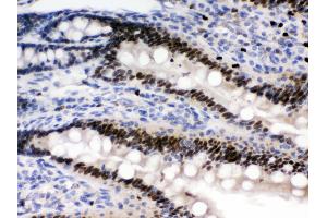 Anti- AMPK beta 2 Picoband antibody, IHC(P) IHC(P): Rat Intestine Tissue