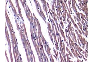 Detection of NPPA in Rat Heart Tissue using Polyclonal Antibody to Natriuretic Peptide Precursor A (NPPA) (NPPA anticorps  (AA 25-152))
