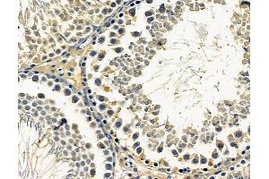 ABIN7096615 and ABIN7100679 at 1/100 staining rat testis tissue by IHC-P. (ARMC9 anticorps)